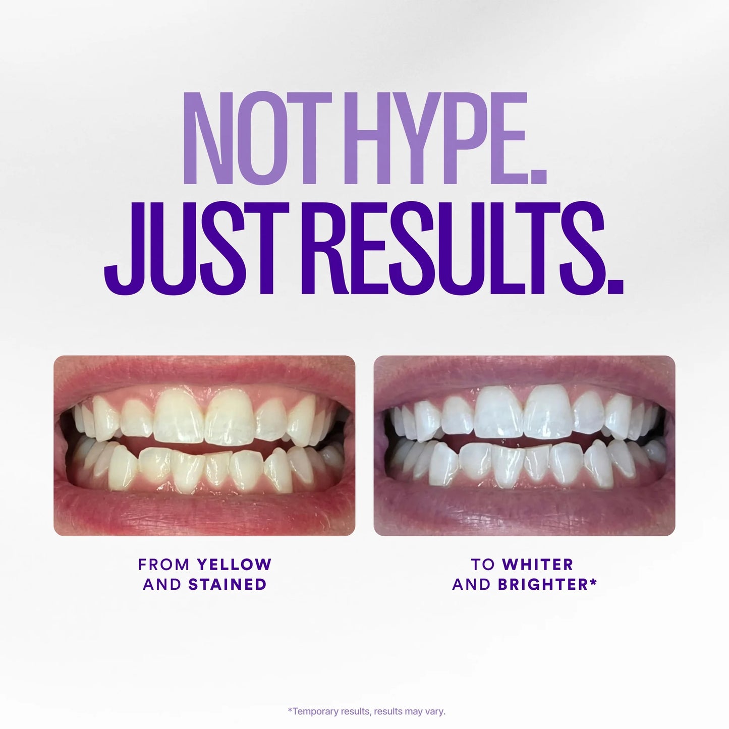 SharpSmile Whitening Strips