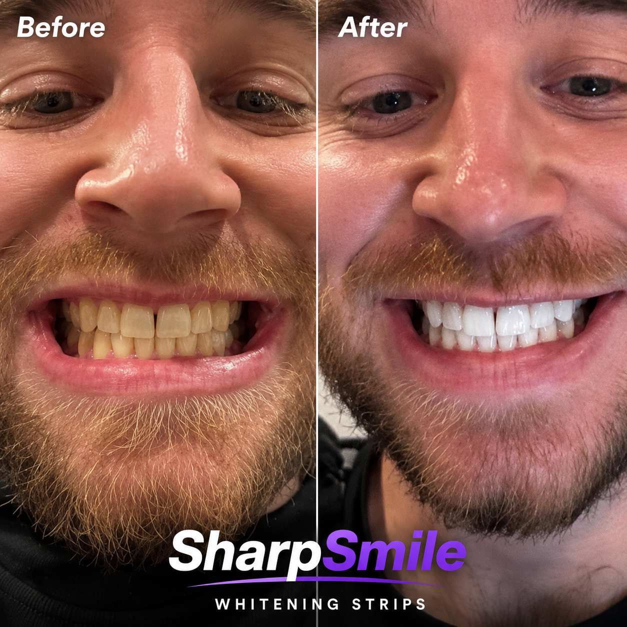 SharpSmile Whitening Strips
