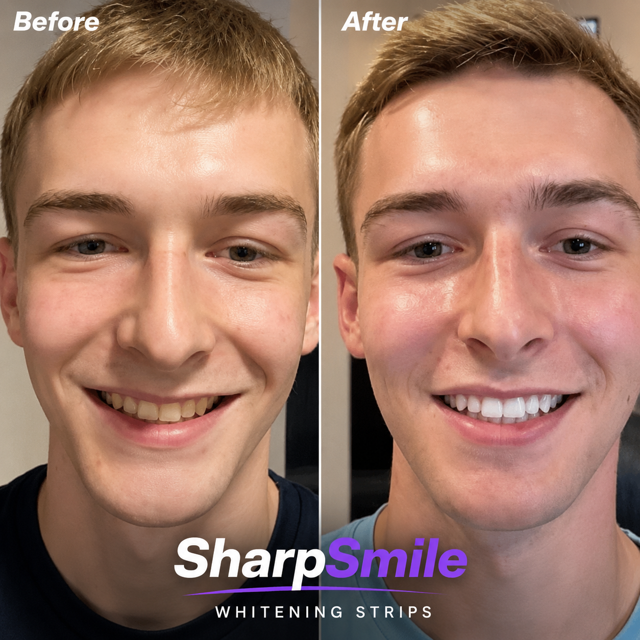 SharpSmile Whitening Strips