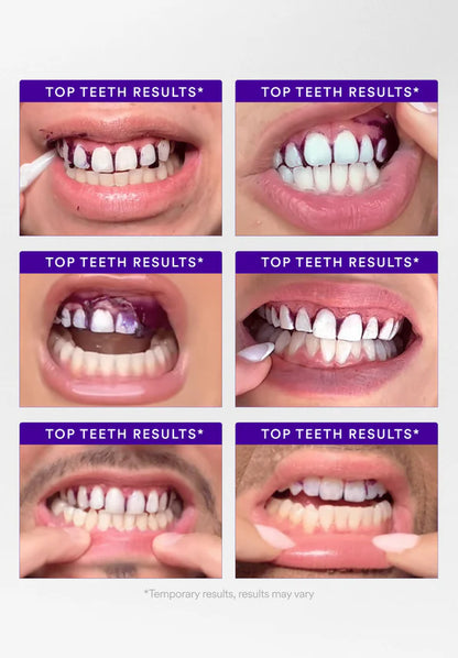 SharpSmile Whitening Strips