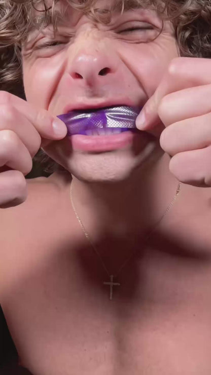 SharpSmile Whitening Strips