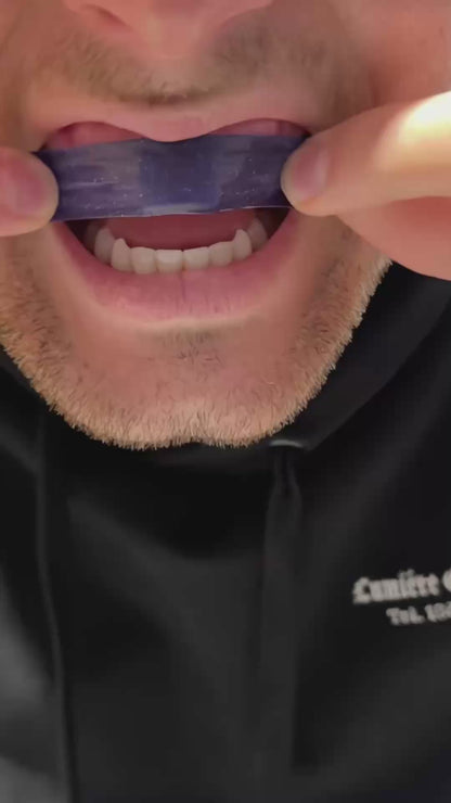 SharpSmile Whitening Strips